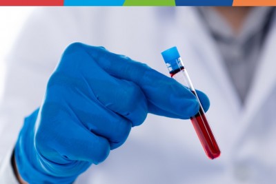 Analize medicale esențiale după excesele de sărbători: Ce să verificăm pentru ficat și colesterol?